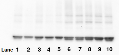 Western blot