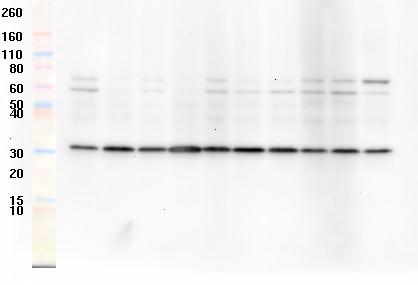 Western blot