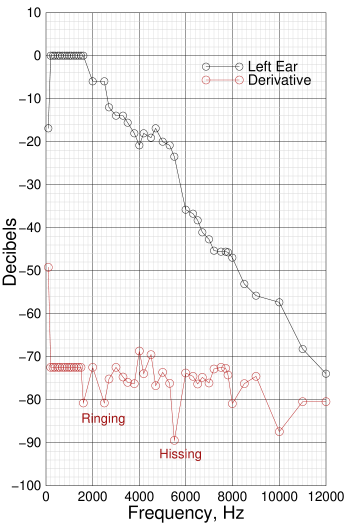 Audiogram made with JDS8060