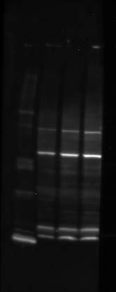 Western blot