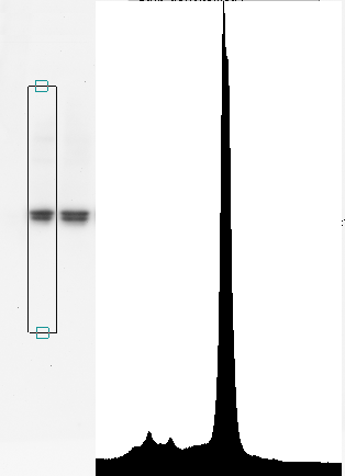 Vertical strip densitometry