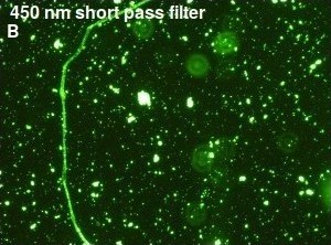 Blue fiber in Alzheimer's disease sample