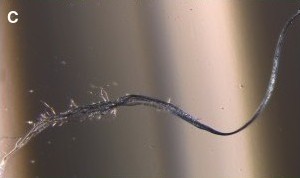 Blue fiber in Alzheimer's disease sample