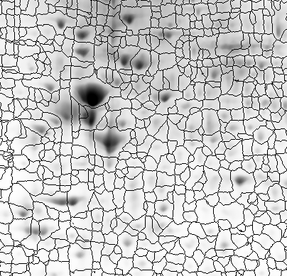 2D gel watershed densitometry