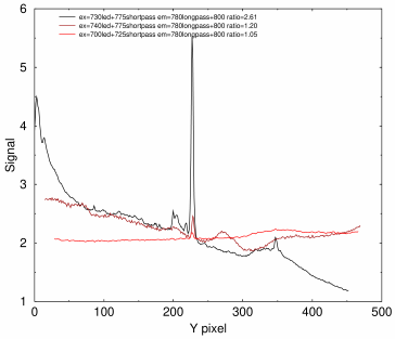 Densitometry tracing