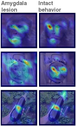 Saliency maps