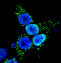 Spike protein in nucleus