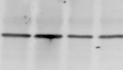 Western blot